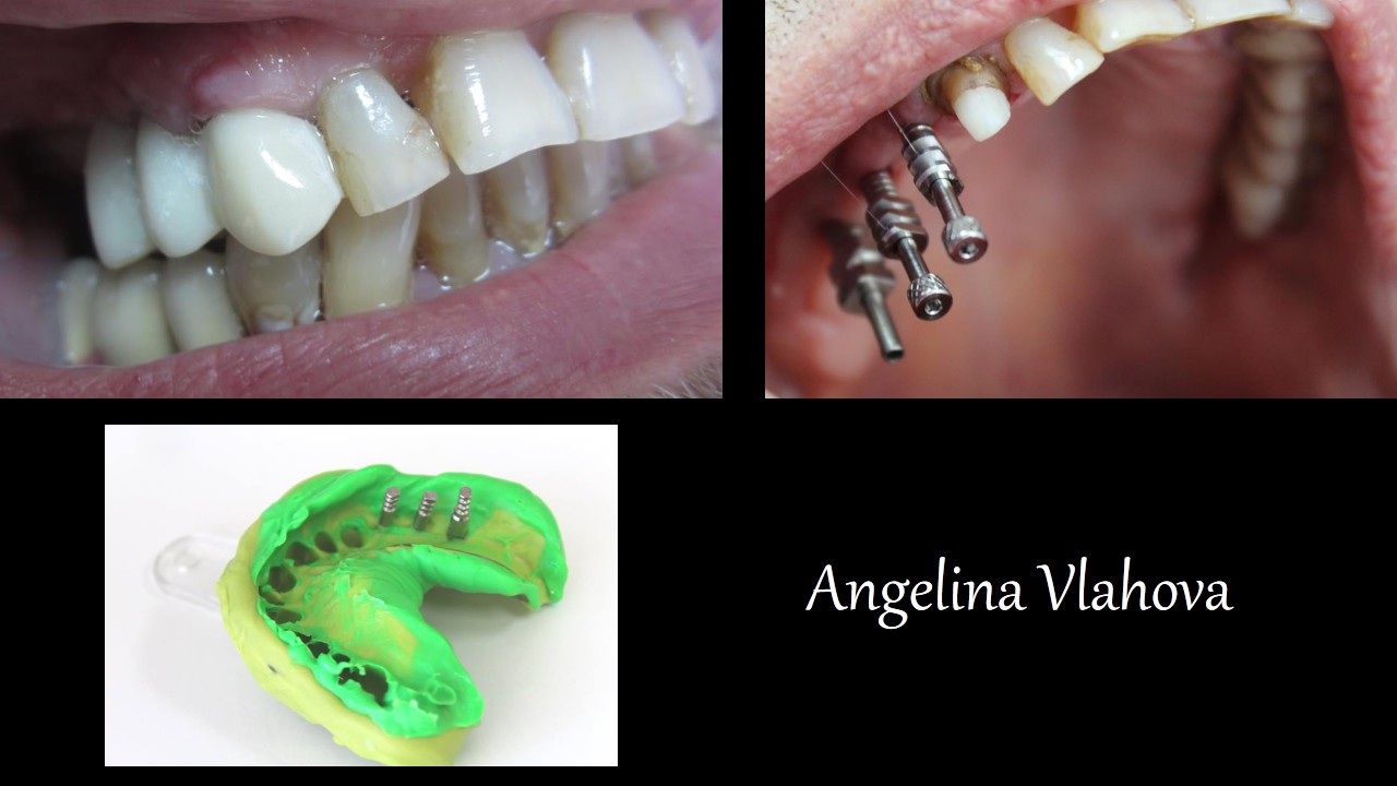 Slide1_1