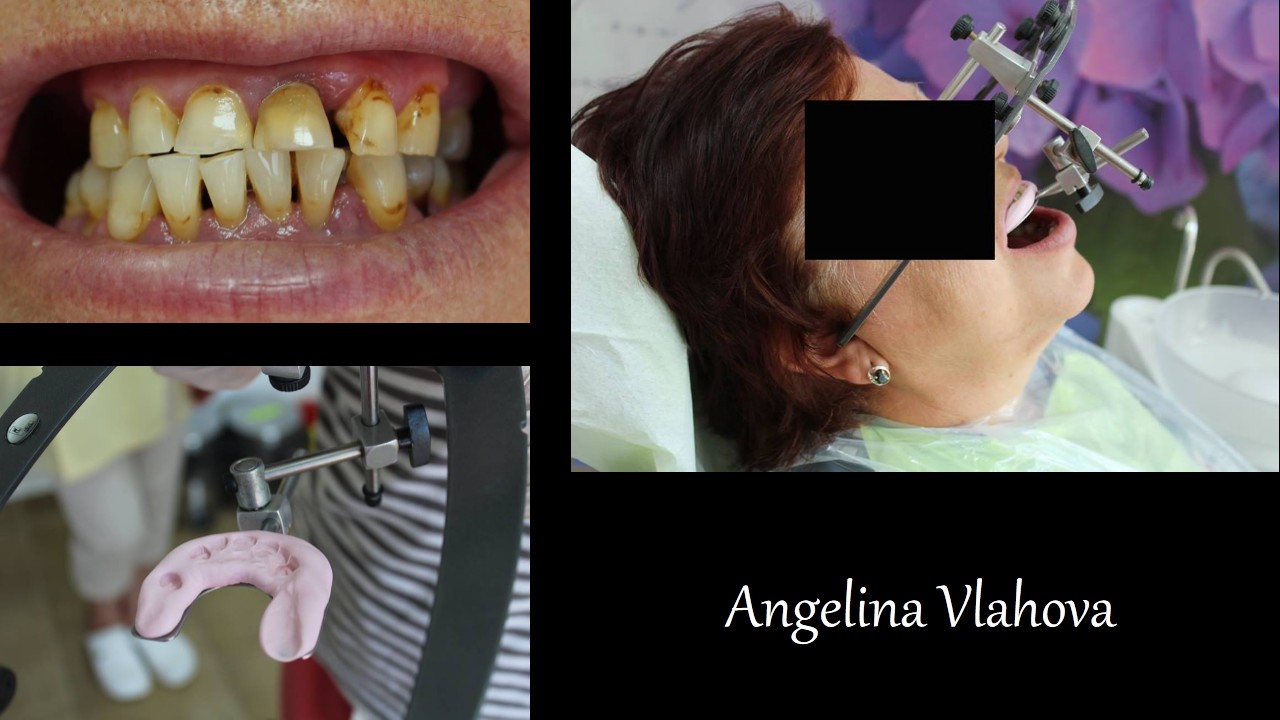 Slide1_3