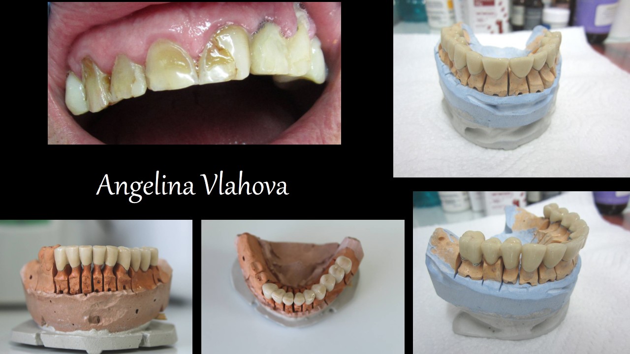Slide1_4