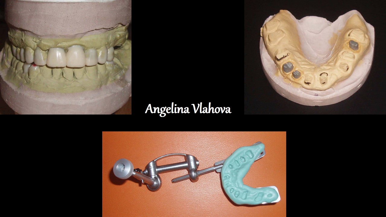 Slide1_5