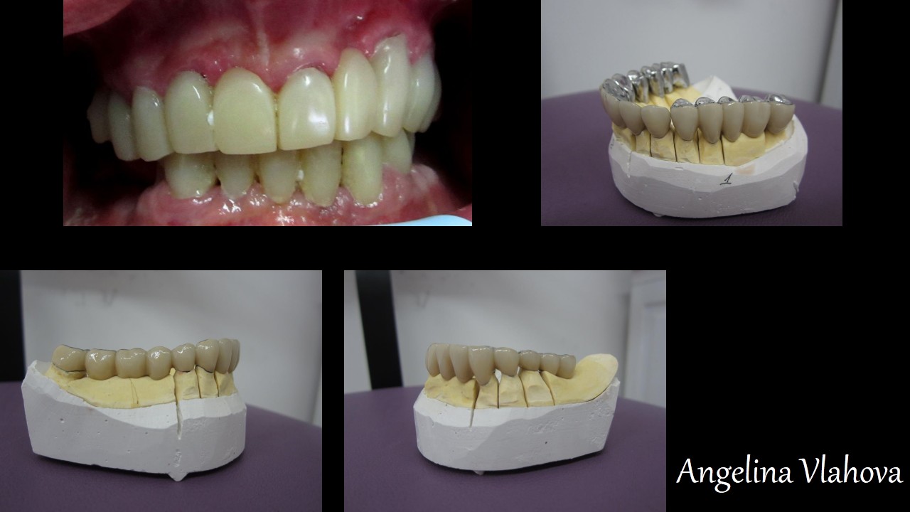 Slide1_7