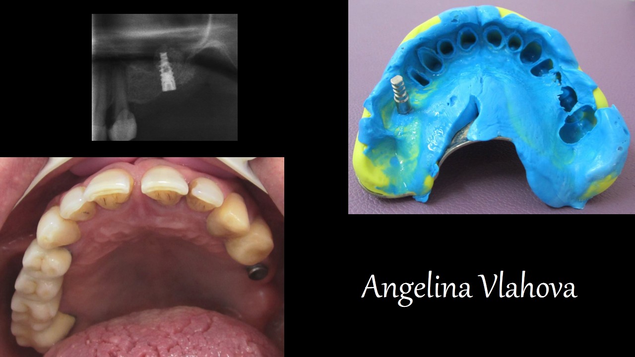 Slide1_8