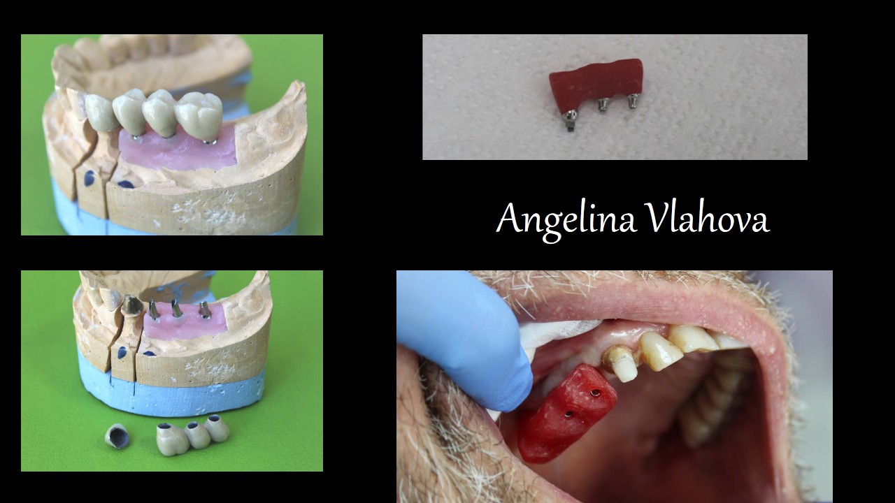 Slide2