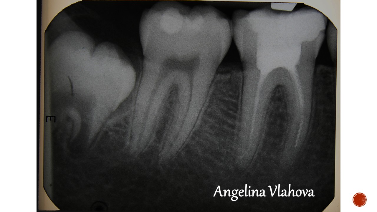 Slide26