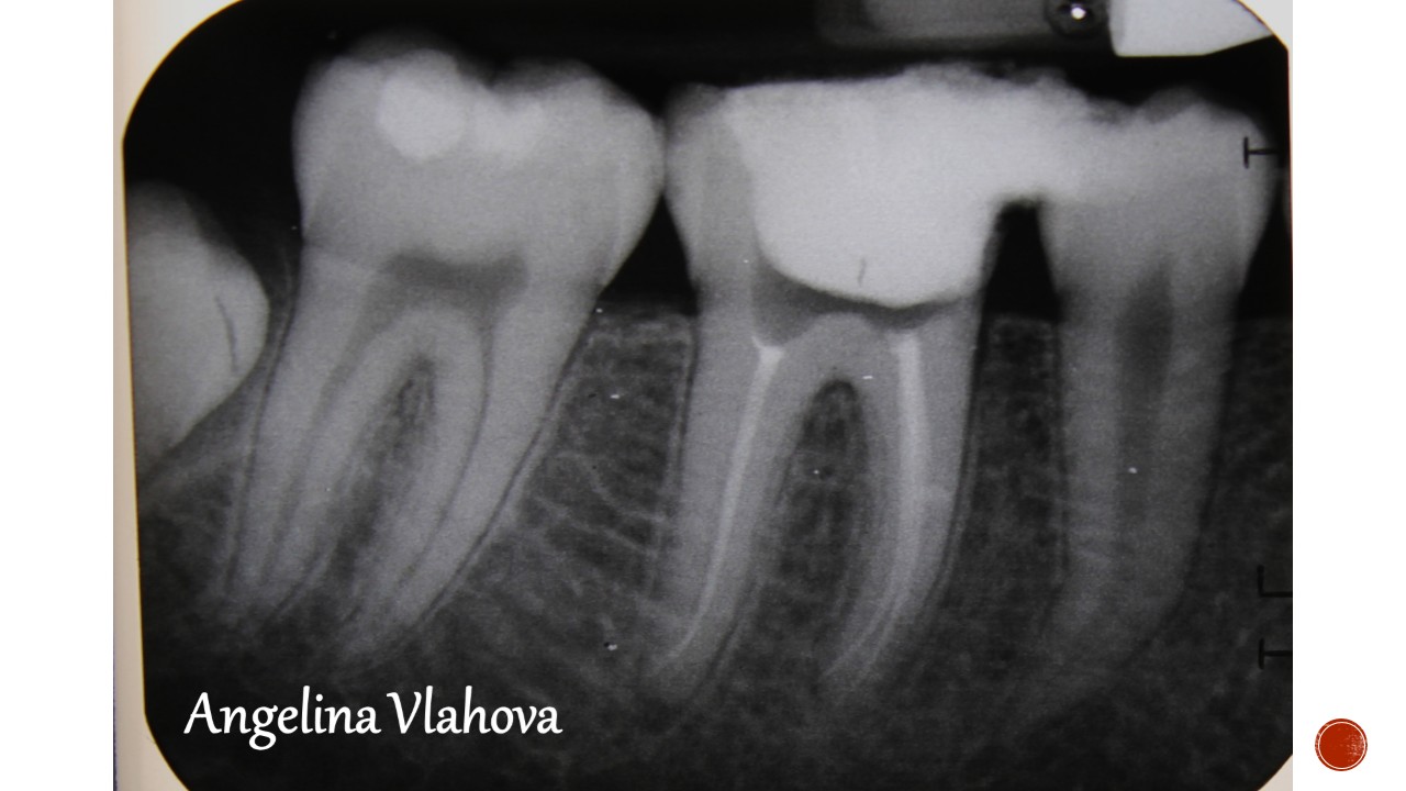 Slide28