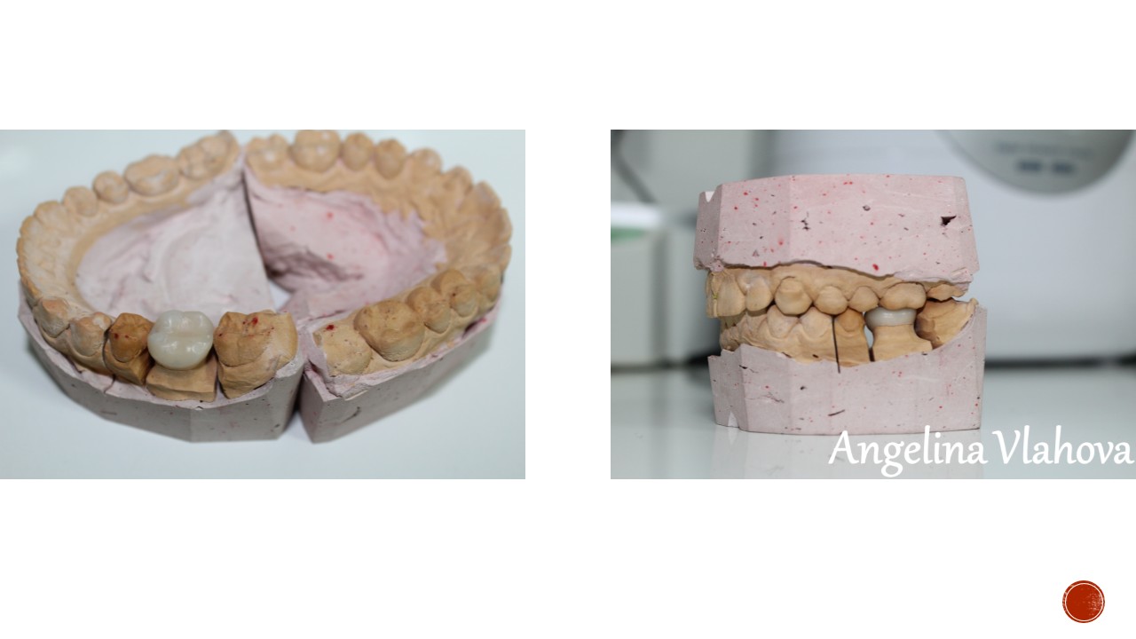 Slide29