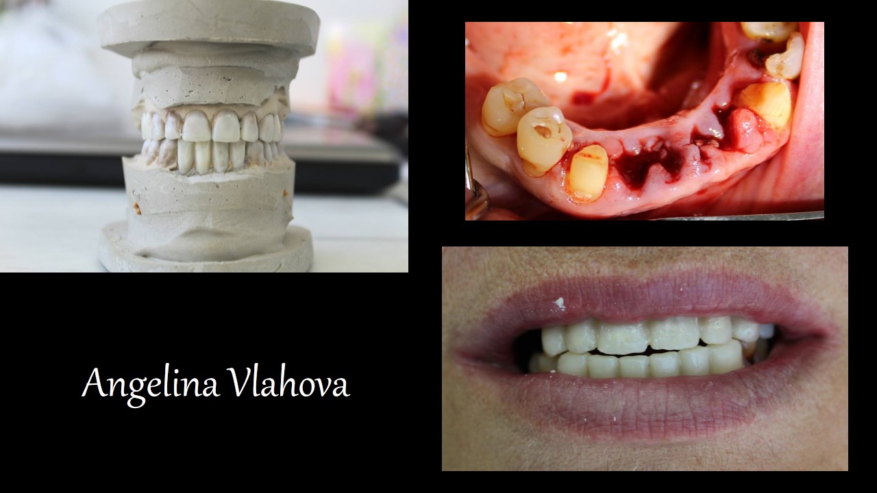 Slide2_1