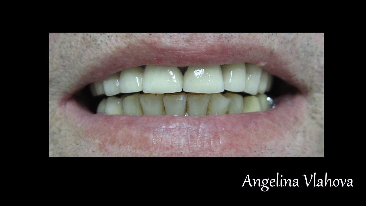 Slide2_2