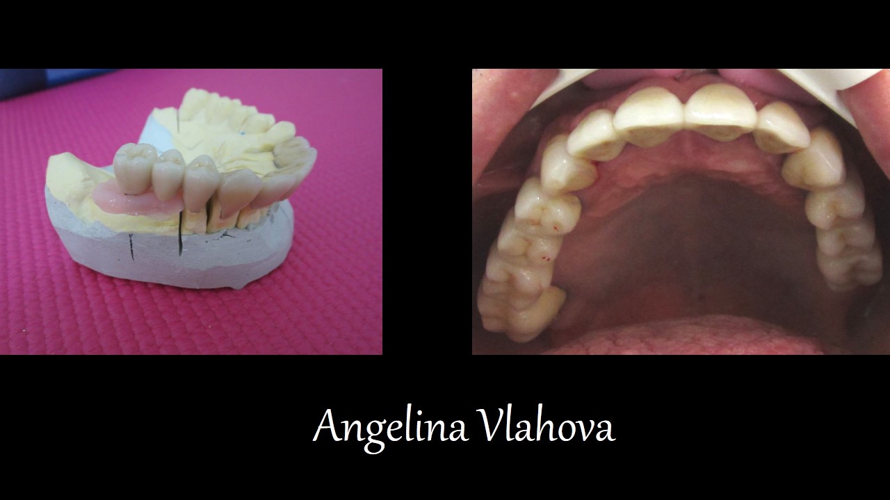 Slide2_6