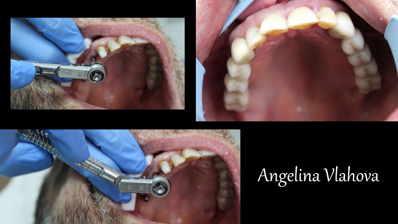 Slide3