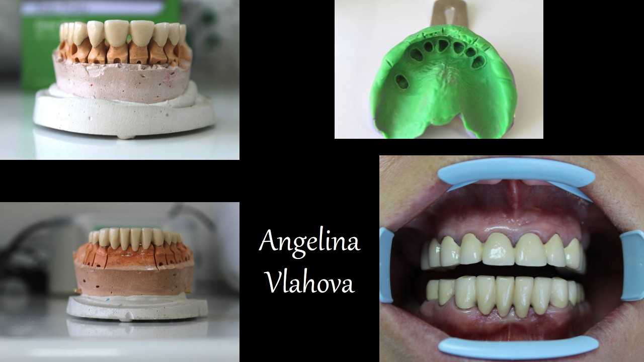 Slide3_1